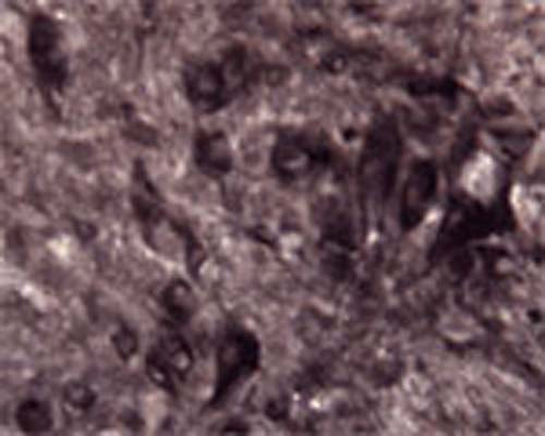 IHC on rat spinal cord (free floating cryo section) using Rabbit antibody to human APP: whole serum (R-070-100) at a dilution of 1: 1000.