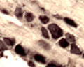 IHC on rat DRG (free floating cryo section) using Rabbit antibody to mouse APP (44-62): whole serum (R-071-100) at a dilution of 1: 1000.