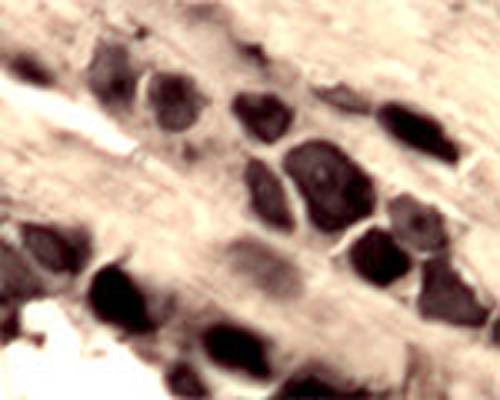 IHC on rat DRG (free floating cryo section) using Rabbit antibody to mouse APP (44-62): whole serum (R-071-100) at a dilution of 1: 1000.