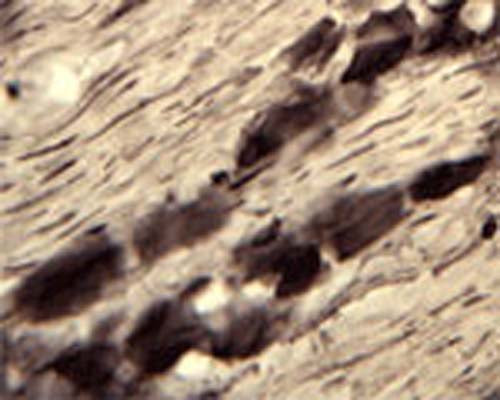 IHC on rat trigeminal nerve (free floating cryo section) using Rabbit antibody to mouse ATPase (147-161): whole serum (R-073-100) at a dilution of 1: 2000.