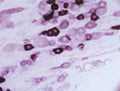Immunohistochemical staining of Vanilloid Receptor Like Protein (VRL-1) in rat trigeminal ganglion using rabbit polyclonal antibody to rat VRL-1, catalogue number R-078-50.