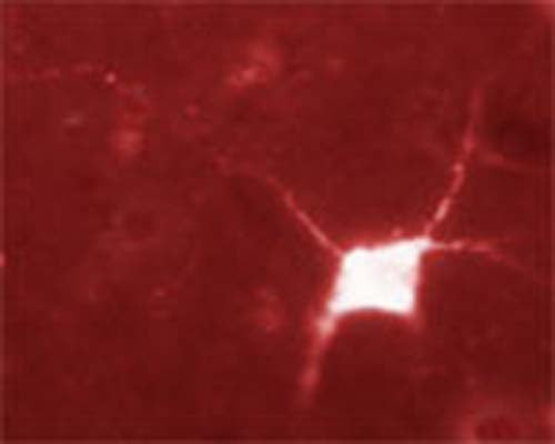 Immunofluorescence staining of human brain (midfrontal cortex, Alzheimer case) fixed in Zamboni. Dilution used: 1:50 (catalogue # R-079-100), free-floating sections, 40X magnification.