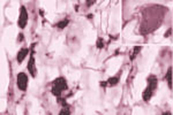 The cryostat section of trigeminal ganglia was stained with the Rabbit antibody to mouse TROY (75-88): whole serum at the dilution of 1: 2000. Following incubation of the section with the primary antibody overnight and secondary antibody for 2 hours, the section was developed with diaminobenzidine substrate with nickel sulfate enhancement.