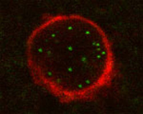 Confocal microscopy on stained ATG5 using Rabbit antibody to ATG5: whole serum (R-111-100) in paraffin-embedded human brain section (midfrontal cortex, Alzheimer case). ATG5 appears green. Red staining is p25.