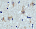DAB staining of ATG5 in paraffin-embedded human brain section (midfrontal cortex, Alzheimer case) using Rabbit antibody to ATG5: whole serum (R-111-100).