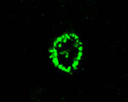 Confocal microscopy on stained ATG12 using Rabbit antibody to ATG12: whole serum (R-112-100) in paraffin embedded human brian section (midfrontal cortex, Alzheimer case).