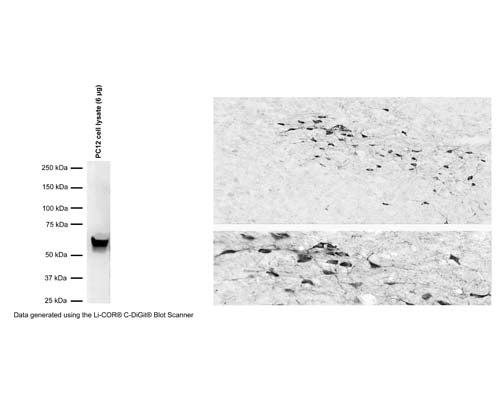 Left: Western Blot analysis of tyrosine hydroxylase (TH) expression in PC12 cell lysate (6 ug protein/lane). The anti-TH rabbit antibody (1:300) detects one specific band at ~60 kDa corresponding to the expected molecular weight of TH. Method: SDS Page: denaturing and reducing, 4-12% Bis-Tris gel; Transfer: Tris-Glycine (Towbin's buffer) with 20% methanol; Membrane: PVDF (0.45 um); Blocking: 5% skim milk in TBST, 1 hr at RT; Primary antibody: R-118-100 (1:300), overnight at 2-8°C; Secondary antibody: donkey anti-rabbit (1:25,000), 1 hr at RT; Detection: Chemiluminescence. Right: Detection of TH-immunoreactivity in dopaminergic neurons in the rat zona incerta in formalin-fixed floated cryostat section by Immunohistochemistry. TH was visualized with the rabbit polyclonal antiserum (R-118-100; 1:100,000) using the biotinylated secondary antibody-ABC method and nickel-diaminobenzidine chromogen. Photo courtesy of Dr. Erik Hrabovszky, Hungarian Academy of Sciences, Budapest, Hungary.