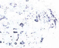 Immunohistochemical staining of Tyrosine Kinase Receptor B (TrkB) in rat spinal cord using rabbit polyclonal antibody to rat TrkB, catalogue number R-121-100.