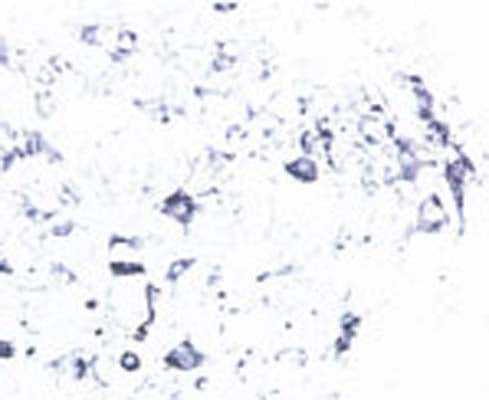 Immunohistochemical staining of Tyrosine Kinase Receptor B (TrkB) in rat spinal cord using rabbit polyclonal antibody to rat TrkB, catalogue number R-121-100.
