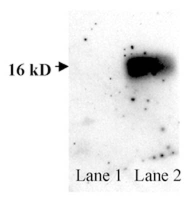 Western blot detection of human SOD1 using Rabbit antibody to human superoxide dismutase (SOD1; 24-36): whole serum (R-125-100) at a dilution of 1 in 500. This antibody detects a band of 16KDa in human Jurkat T cell extracts (lane 2). Its specificity for human SOD1 is shown by the lack of reactivity with mouse brain tissue extract (lane 1).