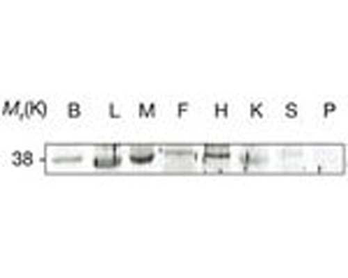 Tissue homogenates from mouse brain (B), liver (L), skeletal muscle (M), fat (F), heart (H), kidney (K), spleen (S) and pancreas (P) were resolved by SDS-PAGE and immunoblotted with Rabbit polyclonal antibody to mouse Adiponectin Receptor 1, catalog number R-1329-100. Image courtesy of Mao et al., (2006) Nature Cell Biology 8:516-523