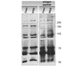 Western Blot using mouse cultured astrocyte extracts at rest (Cntrl) and after 60 mins of ER stress induction by oxygen glucose deprivation (OGD). The left panel membrane was probed with Rabbit polyclonal antibody to mouse PERK: Whole serum (R-1333-100). The right membrane was similarly probed in combination with the antigenic peptide used to generate the antibody. Image taken from Bollo et al (2010) Figure S4.