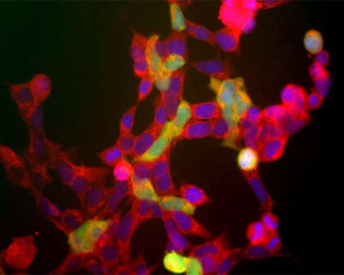 Image shows the human embryonic kidney cells line 293 (Hek293). The red channel shows staining with Rabbit polyclonal antibody to Neuron specific enolase R-1396-50, which recognizes all of these 293 cells. The green channels shows staining for another neuronal marker with Mouse monoclonal antibody to ubiquitin C-terminal hydrolase 1 (UCHL1), M-1407-100. This neuronal gene is apparently activated in a cell density dependent fashion and at this stage only a few cells express this protein. However all cells that express NSE also express UCHL1.