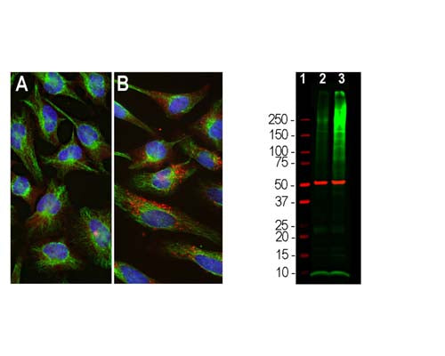 Left: Immunofluorescent analysis of HeLa cells stained with rabbit antibody to ubiquitin (red, 1:1,000) by Immunocytochemistry. Cells were co-stained with chicken antibody to vimentin (C-1409-50, green, 1:10,000). Blue: DAPI nuclear stain. [A] Control HeLa cells maintained in normal medium; [B] HeLa cells treated with 10 uM of the proteasome inhibitor lactacystin (Lc) for 24 hours. Proteasomal inhibition leads to formation of strongly ubiquitin positive cytoplasmic inclusions [B]. Note the diffuse cytoplasmic ubiquitin staining in control cells [A] and well-defined ubiquitin positive inclusions in the Lc treated cells [B]. Right: Western blot analysis of HEK293 cell lysates using rabbit antibody to ubiquitin (green, 1:5,000). [1] protein standard, [2] cells maintained in normal medium, [3] cells treated with proteasome inhibitor lactacystin (Lc) at 10 um for 16 hours. The blot was simultaneously probed with a mouse antibody to beta-tubulin as loading control (red, lanes 2 and 3). The smear detected above the 200 kDa standard represents accumulations of ubiquitinated proteins in the Lc-treated cells. The prominent band at ~8 kDa corresponds to monoubiquitin.