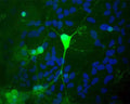 Image shows rat mixed neuron/glial cultures stained with Rabbit polyclonal antibody to Ubiquitin C Terminal Hydrolase 1 R-1408-50 (green). Blue is a DNA stain. Note that the Ubiquitin C Terminal Hydrolase 1 (UCHL1) antibody stains neurons strongly and specifically, and that the staining is concentrated in the cell bodies, though some does extend into the dendrites also. Surrounding glial cells are not stained with this antibody, though many are present as visualized using the DNA stain.