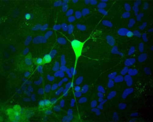 Image shows rat mixed neuron/glial cultures stained with Rabbit polyclonal antibody to Ubiquitin C Terminal Hydrolase 1 R-1408-50 (green). Blue is a DNA stain. Note that the Ubiquitin C Terminal Hydrolase 1 (UCHL1) antibody stains neurons strongly and specifically, and that the staining is concentrated in the cell bodies, though some does extend into the dendrites also. Surrounding glial cells are not stained with this antibody, though many are present as visualized using the DNA stain.