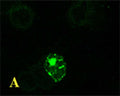 A. Confocal microscopy on immunofluorescently detected MHC class II in cytospin-isolated human white blood cells.