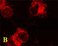 B. Confocal microscopy on immunofluorescently detected MAP1LC3 A in cytospin-isolated human white blood cells using Rabbit antibody to MAP1LC3 A : whole serum (R-146-100) at a dilution of 1: 200, incubated for 1 h at room temperature.