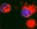 Confocal microscopy on immunofluorescently detected MAP1LC3 A in cytospin-isolated human white blood cells using Rabbit antibody to MAP1LC3 A: whole serum (R-146-100) at a dilution of 1: 200, incubated for 1 h at room temperature. The cells were counter stained with Hoechst Dye (blue colour). Here, the merged picture is presented.