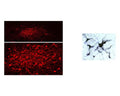 Left: Visualization of dopaminergic neurons in formalin-fixed floated cryostat section from the rat zona incerta by Immunohistochemistry. TH-immunoreactivity was detected with rabbit anti-TH antibody R-148-50 (1:2,000), followed by Cy3-conjugated anti-rabbit antibody. Photo courtesy of Dr. Erik Hrabovszky, Hungarian Academy of Sciences, Budapest, Hungary. Right: Staining of TH-IR catacholaminergic neurons in the rat brainstem using the DAB method.