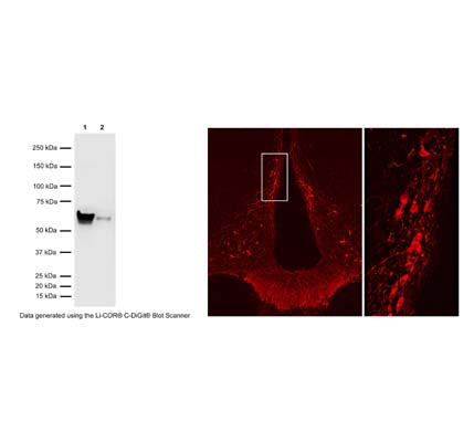 Left: Western Blot analysis of tyrosine hydroxylase (TH) expression in PC12 cell lysate (Lane 1: 6 ug) and mouse brain (Lane 2: 40 ug). The anti-TH rabbit antibody (1 µg/mL) detects one specific band at ~60 kDa corresponding to the expected molecular weight of TH in both samples. Method: SDS Page: denaturing and reducing, 4-12% Bis-Tris gel; Transfer: Tris-Glycine (Towbin's buffer) with 20% methanol; Membrane: PVDF (0.45 um); Blocking: 5% skim milk in TBST, 1 hr at RT; Primary antibody: R-148-50 (1 µg/mL), overnight at 2-8°C; Secondary antibody: donkey anti-rabbit (1:25,000), 1 hr at RT; Detection: Chemiluminescence. Right: Detection of TH-immunoreactivity in tuberoinfundibular dopaminergic neurons in rat hypothalamic arcuate nucleus by Immunohistochemistry. Primary antibody: rabbit anti-TH cat# R-148-50 (1:2,000); Secondary antibody: Cy3-conjugated anti-rabbit. Photo courtesy of Dr. Erik Hrabovszky, Hungarian Academy of Sciences, Budapest, Hungary.
