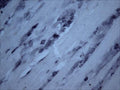 Immunohistochemical staining of Tyrosine Kinase Receptor B (TrkB) in rat trigeminal nerve (free floating cryostat section) using rabbit antibody (R-149-100) at a dilution of 1 in 3000. Courtesy of Professor Xin Fu Zhou, The Flinders University of South Australia.