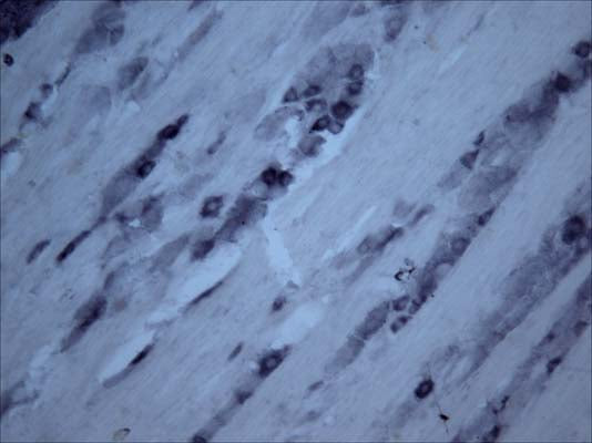 Immunohistochemical staining of Tyrosine Kinase Receptor B (TrkB) in rat trigeminal nerve (free floating cryostat section) using rabbit antibody (R-149-100) at a dilution of 1 in 3000. Courtesy of Professor Xin Fu Zhou, The Flinders University of South Australia.