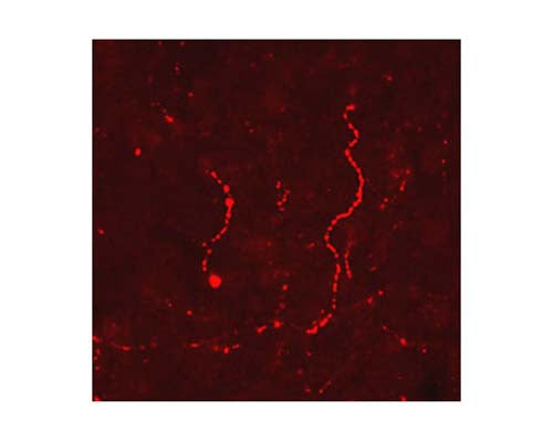 Immunohistochemical staining in rat ventral periaqueductal grey matter (PAG). 4% paraformaldehyde fixed rat brain crystostat sections (10 µm) were incubated overnight at 4°C with Rabbit polyclonal antibody to human beta Lipotropin (10 µg/mL) followed by incubation with donkey anti-rabbit Rhodamine Red conjugated secondary antibody (1:200).
