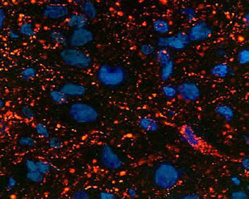 Immunohistochemical staining in rat ventral periaqueductal grey matter (PAG). 4% paraformaldehyde fixed rat brain crystostat sections (10 µm) were incubated overnight at 4°C with Rabbit polyclonal antibody to Endomorphin-2 (10 µg/mL) followed by incubation with donkey anti-rabbit Rhodamine Red conjugated secondary antibody (1:200).