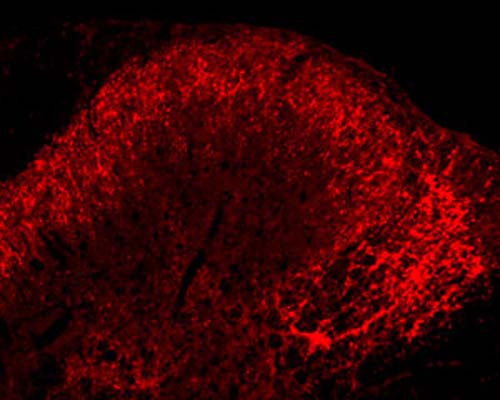 Immunohistochemical staining in rat spinal cord dorsal horn. 4% paraformaldehyde fixed rat brain crystostat sections (10 µm) were incubated overnight at 4°C with Rabbit polyclonal antibody to human Leu-Enkephalin (10 µg/mL) followed by incubation with donkey anti-rabbit Rhodamine Red conjugated secondary antibody (1:200).