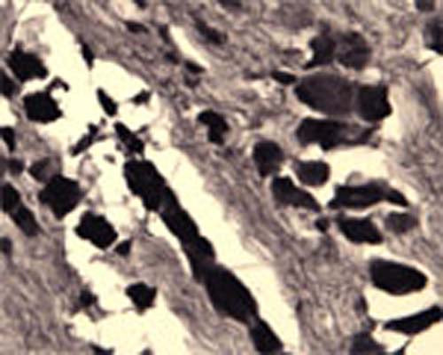 IHC on rat DRG (free floating cryo section) using Rabbit antibody to Sortilin (neurotensin receptor 3): whole serum (R-150-100) at a dilution of 1: 1000.