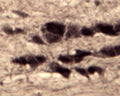 IHC on rat trigeminal nerve (free floating cryo section) using Rabbit antibody to Sortilin (neurotensin receptor 3): whole serum (R-150-100) at a dilution of 1: 1000.