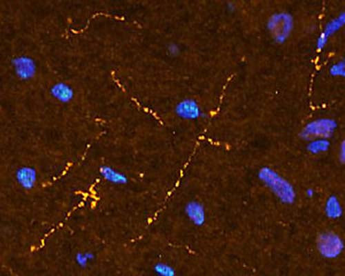 Immunohistochemical staining in rat brainstem medulla. 4% paraformaldehyde fixed rat brain crystostat sections (10 µm) were incubated overnight at 4°C with Rabbit polyclonal antibody to human Somatostatin (10 µg/mL) followed by incubation with donkey anti-rabbit Rhodamine Red conjugated secondary antibody (1:200). Cell nuclei were counterstained with DAPI.