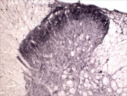 Immunohistochemical staining of Tyrosine Kinase Receptor A (TrkA) in rat spinal cord (free floating cryostat section) using rabbit antibody (R-152-100) at a dilution of 1 in 2000. Courtesy of Professor Xin Fu Zhou, The Flinders University of South Australia.