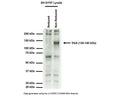 Western blot of TrkA receptor in human neuroblastoma SH-SY5Y cell lysate (30 µg/lane). R-152-100 detects TrkA full-length protein at 130-140 kDa under non-reducing conditions (no DTT or beta-mercaptoethanol!). Higher molecular-weight bands may represent homodimeric forms of TrkA or heterodimeric TrkA-receptor complexes. The identity of lower molecular weight bands is unknown. SDS-PAGE: denatured and non-reducing; Transfer: Tris-Glycine buffer; Membrane: nitrocellulose (0.45 um); Blocking: 5% skim milk in TBST, 1 hour at RT; Primary antibody: overnight at 4°C (1/2500 dilution); Secondary antibody: anti-rabbit-HRP (1/6000) 2 hours at RT; Detection: Chemiluminiscence. Predicted MW of humanTrkA based on amino acid sequence: 84 kDa. The observed MW differs due to post-translational modification, mainly glycosylation.