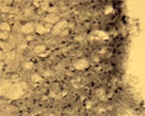 Immunohistochemical detection of Arg3.1 in free floating cryosectioned rat spinal cord (dorsal horn) using Rabbit antibody to Arg3.1 (ARC): whole serum (R-154-100) at a dilution of 1: 250.