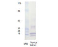 Western Blot analysis of Rabbit polyclonal antibody to Histone H3 (R-1549-100) in calf thymus protein extract.