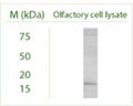 Western blot under reducing conditions on Olfactory cell line (Odora) lysate using Rabbit antibody to MAP1LC3 B : whole serum (R-155-100) at a dilution of 1:100.