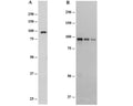 Western Blot in mouse brain extracts using Rabbit polyclonal to mouse elF2c protein (R-1556-100). Figure A: Total mouse brain extract. Detection at 0.03 µg/mL. Protein loaded 20 µg. Figure B: Mouse cytosolic brain extract. Detection at 0.03 µg/mL. Protein loaded 20 µg, 10 µg and 5 µg.