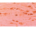 IHC staining of Rabbit antibody to Neurturin (R-1561-100) in rat dorsal root ganglia (at 1:1,000).