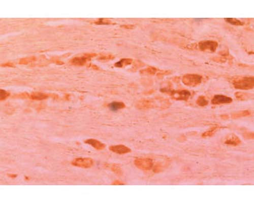 IHC staining of Rabbit antibody to Neurturin (R-1561-100) in rat dorsal root ganglia (at 1:1,000).