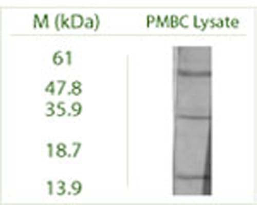 Western blot on Peripheral Blood Mononuclear Cells (PMBC) lysate using Rabbit antibody to ATG4B (APG4B): whole serum (R-157-100) at a dilution of 1:100 (ECL)