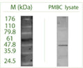 Western blot (non-reduced) on Peripheral Blood Mononuclear Cells (PMBC) lysate using Rabbit antibody to ATG16 L1: whole serum (R-158-100) at a dilution of 1: 100 (ECL).