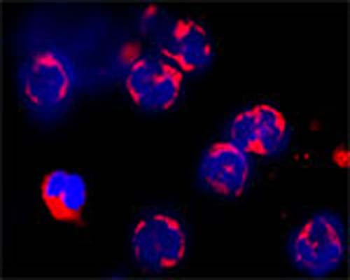 Confocal microscopy on immunofluorescently detected ATG3 in cytospin-isolated human white blood cells using Rabbit antibody to ATG3: whole serum (R-159-100) at a dilution of 1: 100, incubated for 1 h at room temperature. The cells stained for ATG3  appear in red . The cells were counter stained with Hoechst Dye  (blue colour). Here, the merged picture is presented. More information on the staining: Fixation: In acetone for 90 seconds. Antibody dilutions: Primary antibody was diluted 1:100 and incubated for 1 hour, washed then 3x, and the secondary (Goat anti Rb 1:100 Alexa 546 conjugate) was incubated for 30 minutes. Magnification 80X. No staining was observed using the Pre-immunisation serum. No staining was observed in HL60 cell line using Rabbit antibody to ATG3: whole serum (R-159-100)