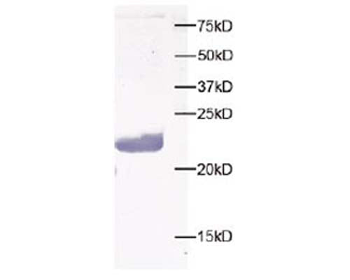 Western Blot image of human brain tissue using Rabbit polyclonal antibody to Peroxiredoxin-5 (R-1595-100).