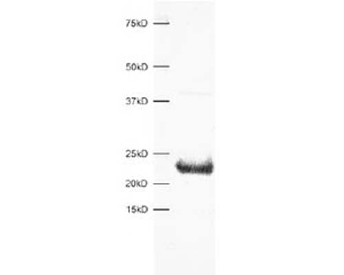 Western Blot image of human brain tissue using Rabbit polyclonal antibody to human mitochondrial Mn superoxide dismutase (R-1596-100).
