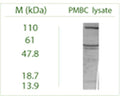 Western blot on Peripheral Blood Mononuclear Cells (PBMC) lysate using Rabbit antibody to ATG9A (APG9L1): whole serum (R-160-100) at a dilution of 1: 100 (ECL).