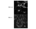 Presenilin 1 detection in PS1 positive and knock-out neurosphere derived cells after differentiation. Immunofluorescence after 4% paraformaldehyde fixation for 15 min, PS1[1-20] protein A-purified (20 µg/mL).