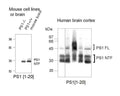 Western Immunoblotting of human and mouse Presenilin 1 protein in mouse cell line extracts and mouse and human brain. Membrane protein load 20 µg. Crude anti-PS1 NT used at 1:2000.
