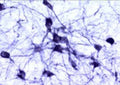 Immunohistochemical staining of catecholaminergic neurons in the rat brain stem.